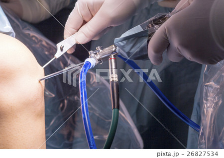 Surgical operation knee surgery Surgical operation knee surgery 26827534