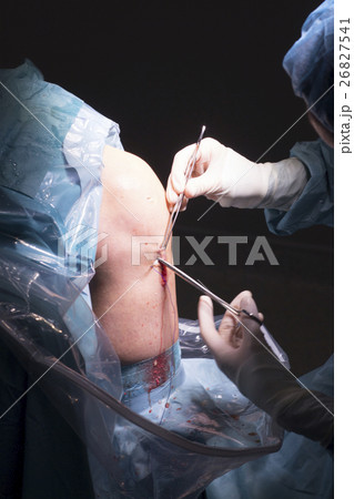 Surgical operation knee surgery Surgical operation knee surgery 26827541