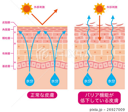 皮膚構造 乾燥肌 断面図のイラスト素材