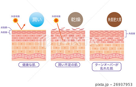 健康な肌　潤い不足の肌　ターンオーバーが乱れた肌 26937953