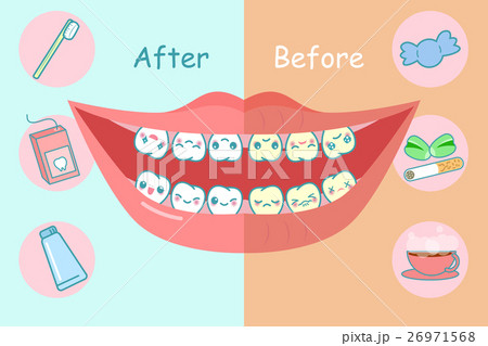 Before and after teeth 26971568