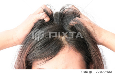 Woman serious hair loss problem for health Woman serious hair loss problem for health 27077488