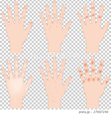 Rough hand 27087240
