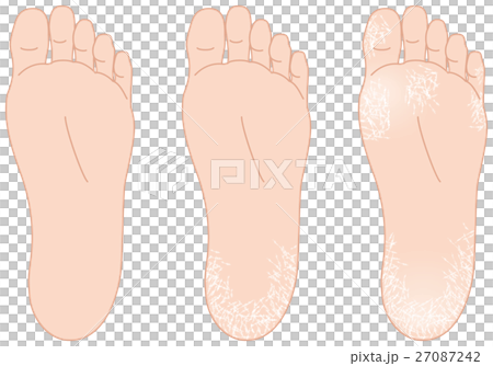 腳底的質量很好 27087242