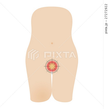 female health problem concept 27272922