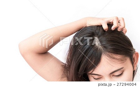 Closeup woman hand itchy scalp, Hair care concept 27294004