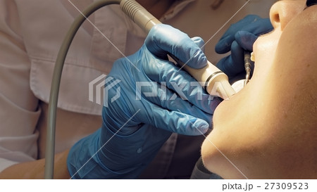 Woman ultrasonic tooth plaque odontolith removing 27309523