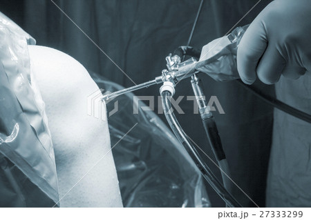 Surgical operation knee surgery Surgical operation knee surgery 27333299