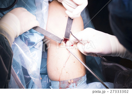 Surgical operation knee surgery Surgical operation knee surgery 27333302