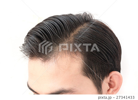 Young man worry hair loss problem 27341433