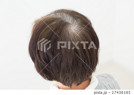 シニアの頭髪　白髪 27436165