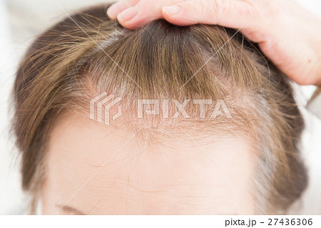 シニアの頭髪　白髪 27436306