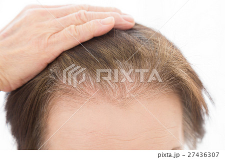 シニアの頭髪　白髪 27436307
