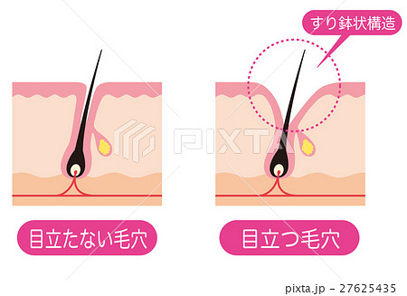 Pore Section Opened Pore - Stock Illustration [27625435] - PIXTA