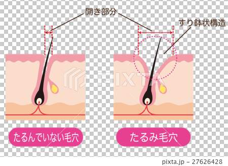 毛穴の断面 開いた毛穴 毛穴の断面 開いた毛穴 27626428