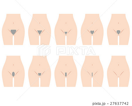 アンダーヘアのデザイン　脱毛 27637742