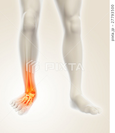 Ankle painful - skeleton x-ray. 27793500