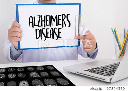 Alzheimers Disease concept , Brain degenerative Alzheimers Disease concept , Brain degenerative 27824559