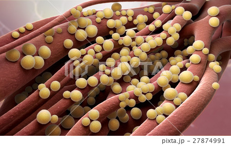 Staphylococcus aureus Staphylococcus aureus 27874991