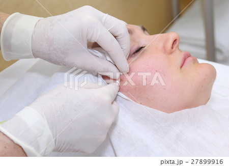 Procedure of face lifting surgery. 27899916