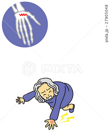 おばあさん骨折 27905048
