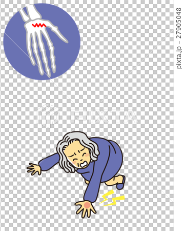 おばあさん骨折 27905048