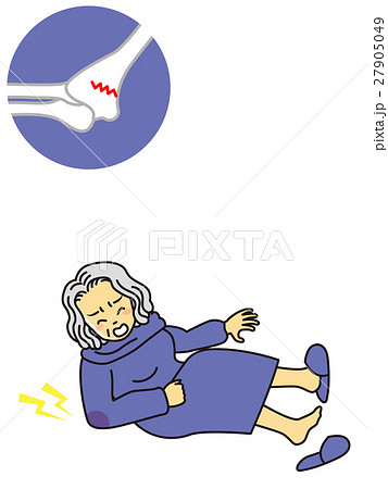 おばあさん骨折 おばあさん骨折 27905049