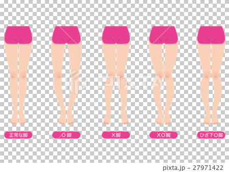 O脚矯正　骨盤のゆがみ 27971422