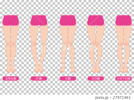 O脚矯正　骨盤のゆがみ 27971461