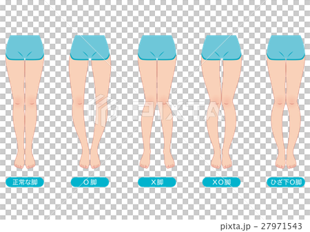 Distortion of O leg legal pelvis 27971543