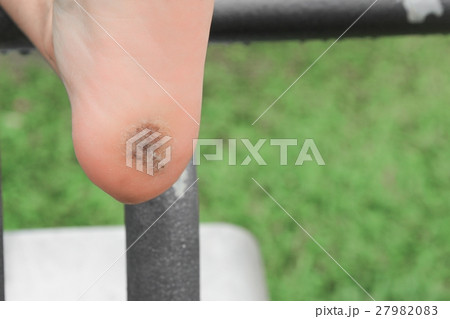 foot corn :Select focus with shallow depth of field. 27982083
