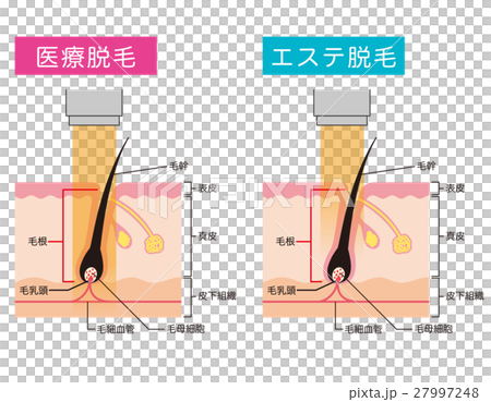 医療脱毛　エステ脱毛 27997248