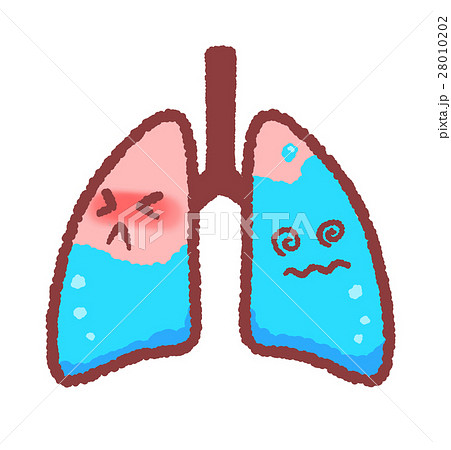 肺 に 水 が 溜まる 病気