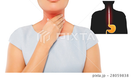 Woman suffering from acid reflux or heartburn 28059838