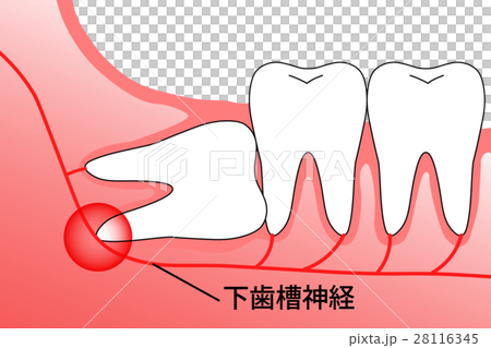 親知らず 埋伏智歯のイラスト素材