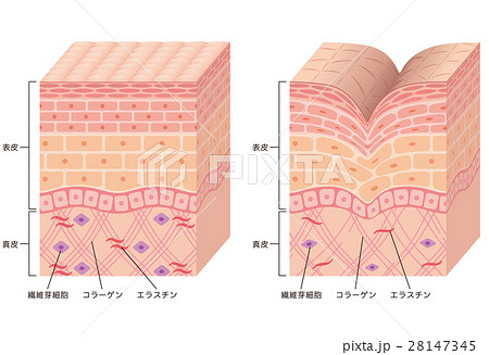 しわ 皮膚の構造 断面図のイラスト素材 28147345 Pixta