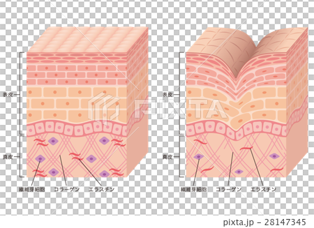 Structural cross section of wrinkle skin - Stock Illustration [28147345 ...