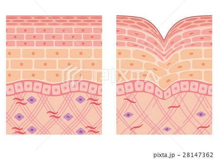 しわ 皮膚の構造 断面図のイラスト素材