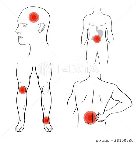 Set of people with pain dots. 28160536