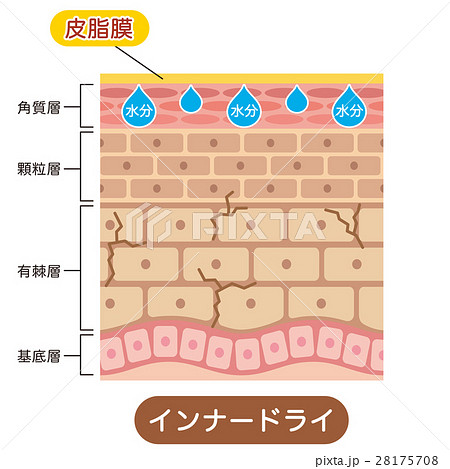 インナードライ肌 肌図のイラスト素材