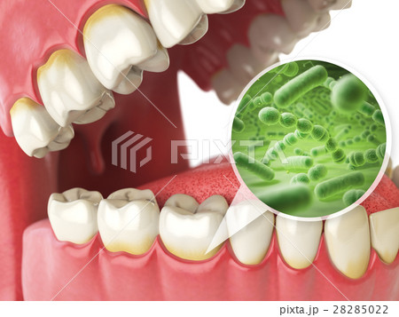 Bacterias and viruses around tooth. Dental hygiene 28285022