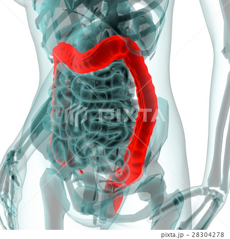 医療系cg 大腸 のイラスト素材 4278