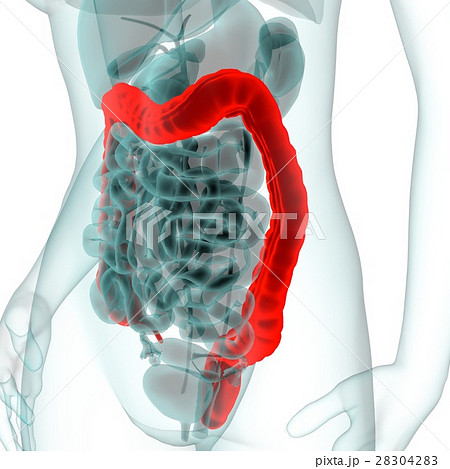 医療系CG(大腸) 医療系CG(大腸) 28304283