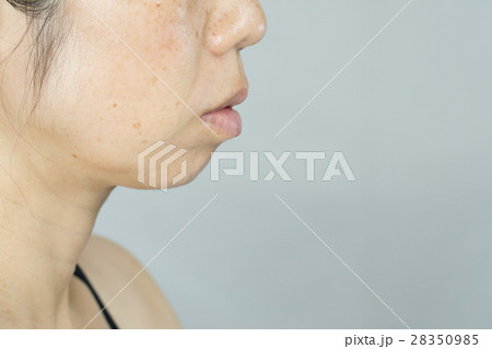 すっぴん  ノーメイク　しみ、そばかす、ほうれい線に悩む中年女性 28350985