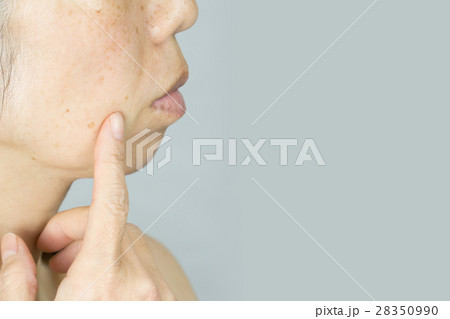 すっぴん  ノーメイク　しみ、そばかす、ほうれい線に悩む中年女性 28350990