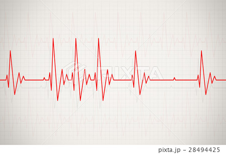 Irregular Heartbeat Illustration 28494425