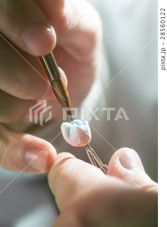 Dental Prosthesis Dental Prosthesis 28560122