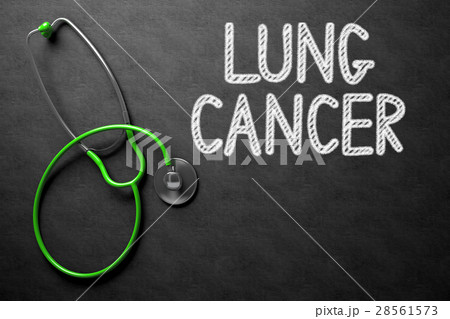 Lung Cancer on Chalkboard. 3D Illustration. 28561573