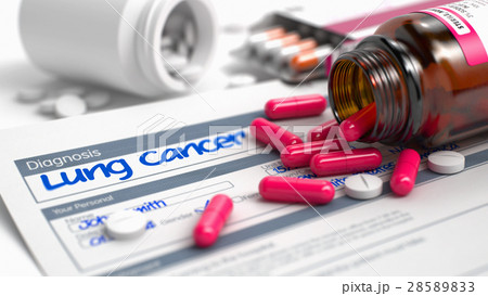 Lung Cancer - Text in Anamnesis. 3D Render. 28589833