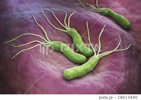 Helicobacter Pylori bacteria 28613890